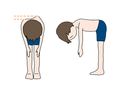 医療法人宏洲整形外科医院 篠栗 側弯症