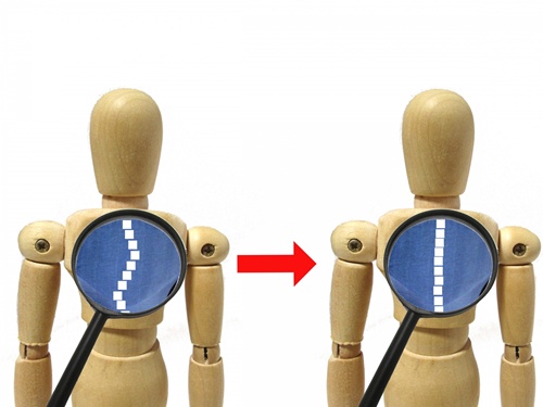 医療法人宏洲整形外科医院 篠栗 側弯症